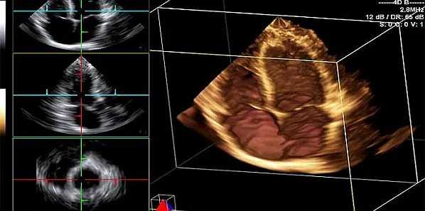 AHA to Clinicians: Know the Radiation Risks of Heart Imaging