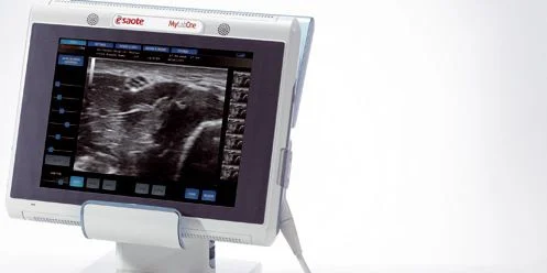 Esaote Launches Tablet-Size Vascular Ultrasound System  