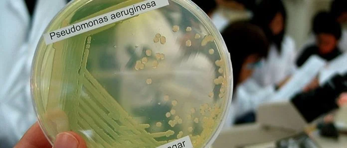 130130-pseudomonas-aeruginosa-denn-flickr-940.jpg