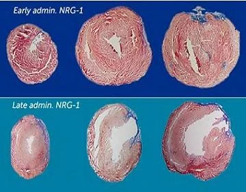 Heart muscle cells regenerate the fastest in the first six months of life