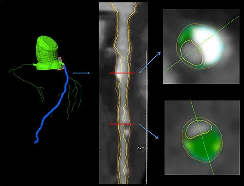 CT images in 62-year-old man