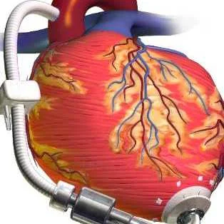 CAR: Europe and South America Lead in IC Device Adoption 