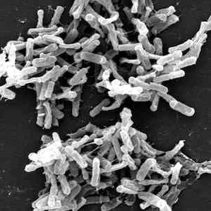 C. Difficile