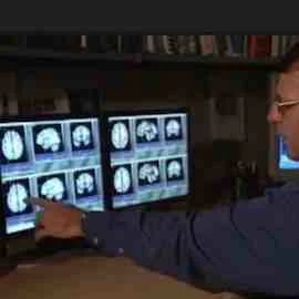 Radiologist reviewing brain MRI scans