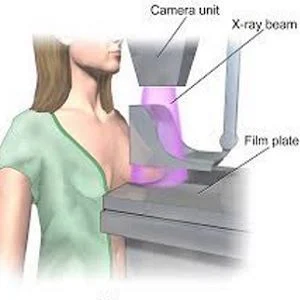 illustration of a mammogram