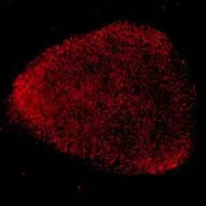 Patient-derived Stem Cells