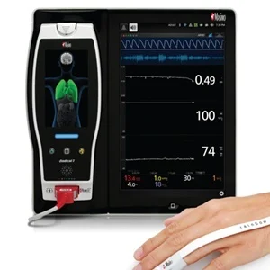 In New Clinical Study Masimo&rsquo;s Oxygen Reserve Index Helps Clinicians Detect Impending Desaturation in Pediatric Patients