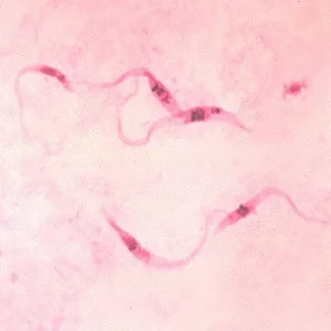 Chagas Disease