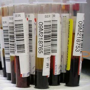 blood samples  