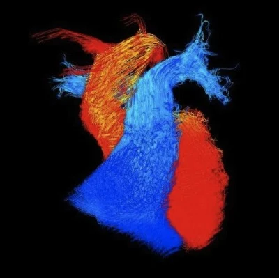 4D Cardiac MRI Wins BHF Research Image Award