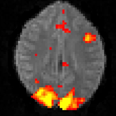 Brain activity