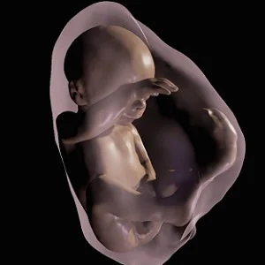 A 3-D virtual model MRI view of fetus at 26 weeks.