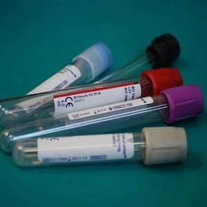 One-Third of Lab Tests Not Needed 