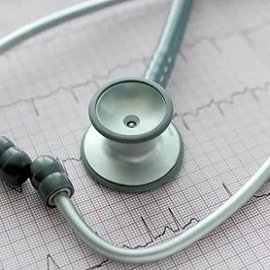 A new study has found that dementia rates increase when anticoagulation treatment is delayed for patients with atrial fibrillation, the most common heart arrhythmia in the world that affects more than 2.7 million American adults.