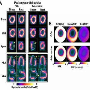 Panel A shows representative short and long-axis PET images of peak myocardial uptake of 13N-ammonia during hypercapnia of PaCO2 ~ 60 mmHg (CO2), standard clinical dose of adenosine (Adenosine) and at rest with PaCO2 ~ 35 mmHg (Rest) in a canine with a LA