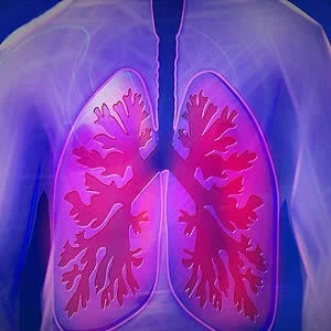 Cost-effective Lung Cancer Screening Programmes