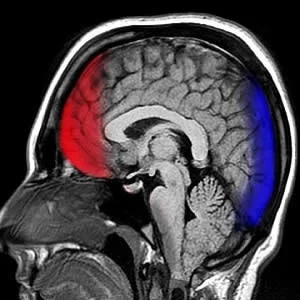 Head CT for prognostication