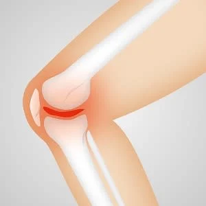 Radiography as complementary imaging tool for osteoarthritis studies 