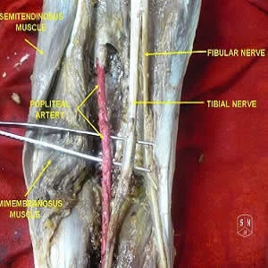 Dynamic ultrasound for detecting soleus arcade syndrome