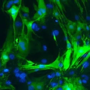 These cardiomyocytes (green with blue nuclei) had been fibroblasts before Frank Conlon&#039;s UNC lab reprogrammed them.