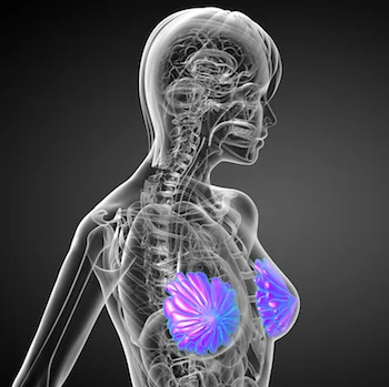 AI-radiomics mammography combo reduces breast biopsies 