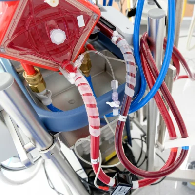 Models for predicting outcome in patients under VA-ECMO 