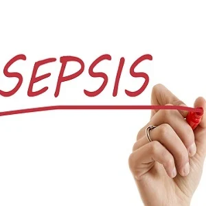 Immunotherapy effects on sepsis