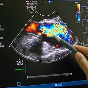 The Year in Cardiology Imaging 