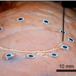 3D Printing on Breathing Lung