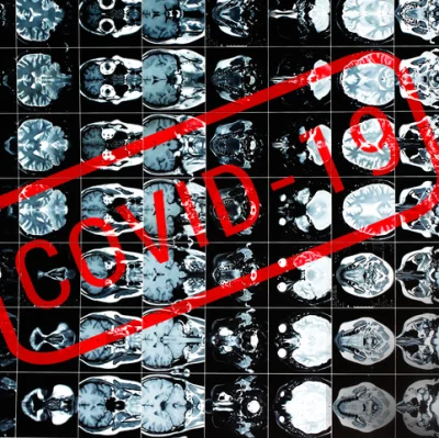 One Year Later: Imaging Findings during Covid-19