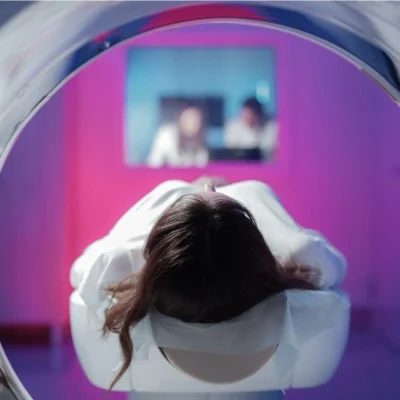 Synthetic MRI in Subarachnoid Haemorrhage