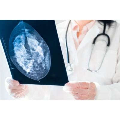 AI as Second Reader Performs Well in Breast Cancer Screening 