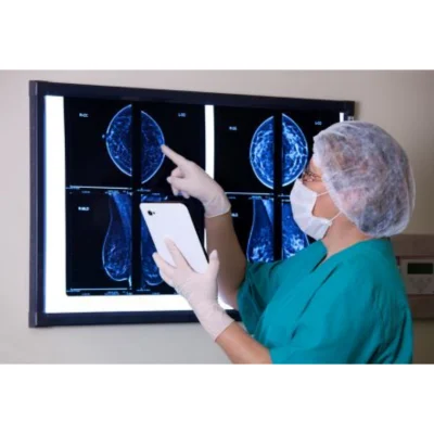 AI in Population Breast Screening Cuts Radiologist Workload by 63%