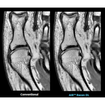 A Bold New World: GE Healthcare&rsquo;s Pioneering Deep Learning Image Reconstruction Technology 