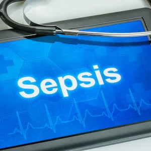 Serial Measurement of Pancreatic Stone Protein for Detection of Sepsis 