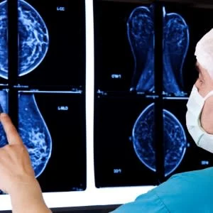 Study Finds Women with Benign Breast Disease Face Long-Term Risk of Breast Cancer