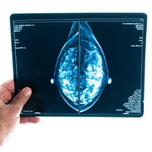 AI Demonstrates Comparable Performance to Human Mammogram Readers