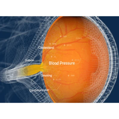 Toku Obtains CE and UKCA Marks for AI Cardiovascular Risk Assessments Through the Eye