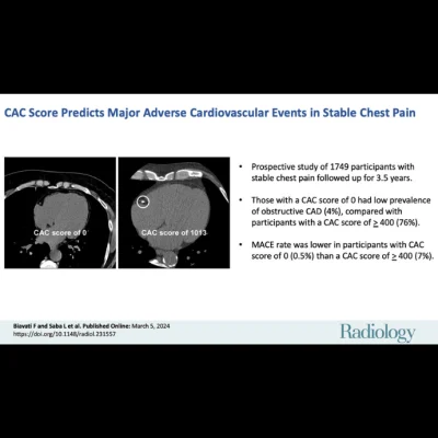 Coronary Artery Calcium Score Could be Predictor of Heart Attacks &amp; Strokes