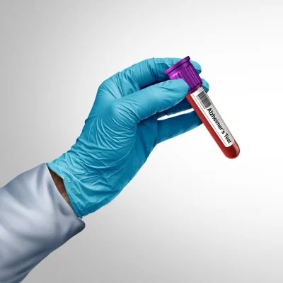 Revolutionising Alzheimer&#039;s Diagnosis with Light-Based Blood Test 