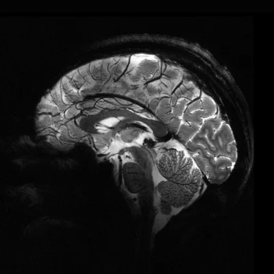 World&rsquo;s Most Powerful MRI Machine Offers Unprecedented Clarity in Brain Imaging