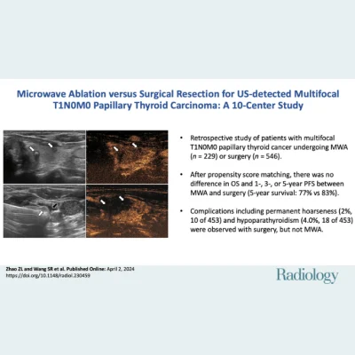 Microwave Ablation Offers New Treatment Options for Thyroid Cancer Patients