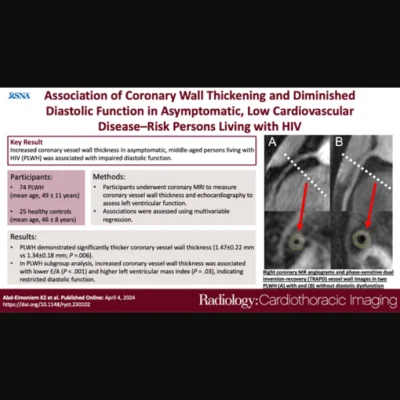 MRI Detection of Coronary Artery Pathology and Diastolic Dysfunction HIV+ patients