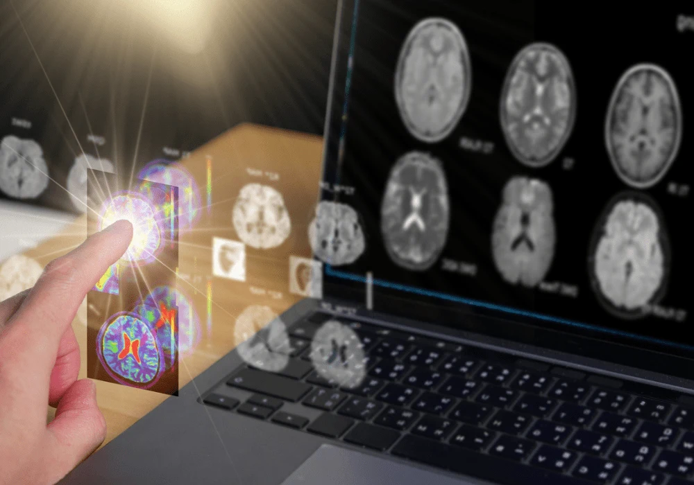 Versatile and Accurate DL Model for Amyloid Positivity Prediction in PET Scans