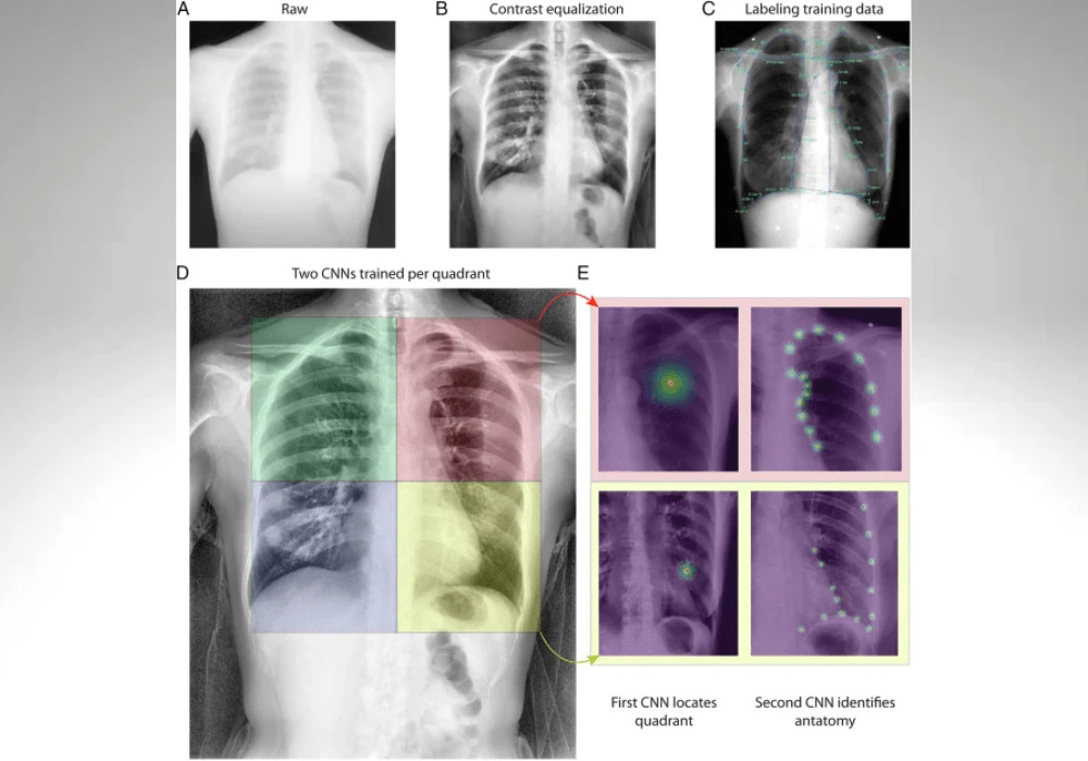 Automated Dynamic Digital Radiography for Pulmonary Function Testing