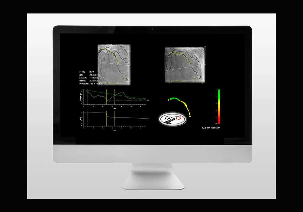 Pie Medical Imaging Announces Enrollment Completion of the FASTIII Clinical Trial