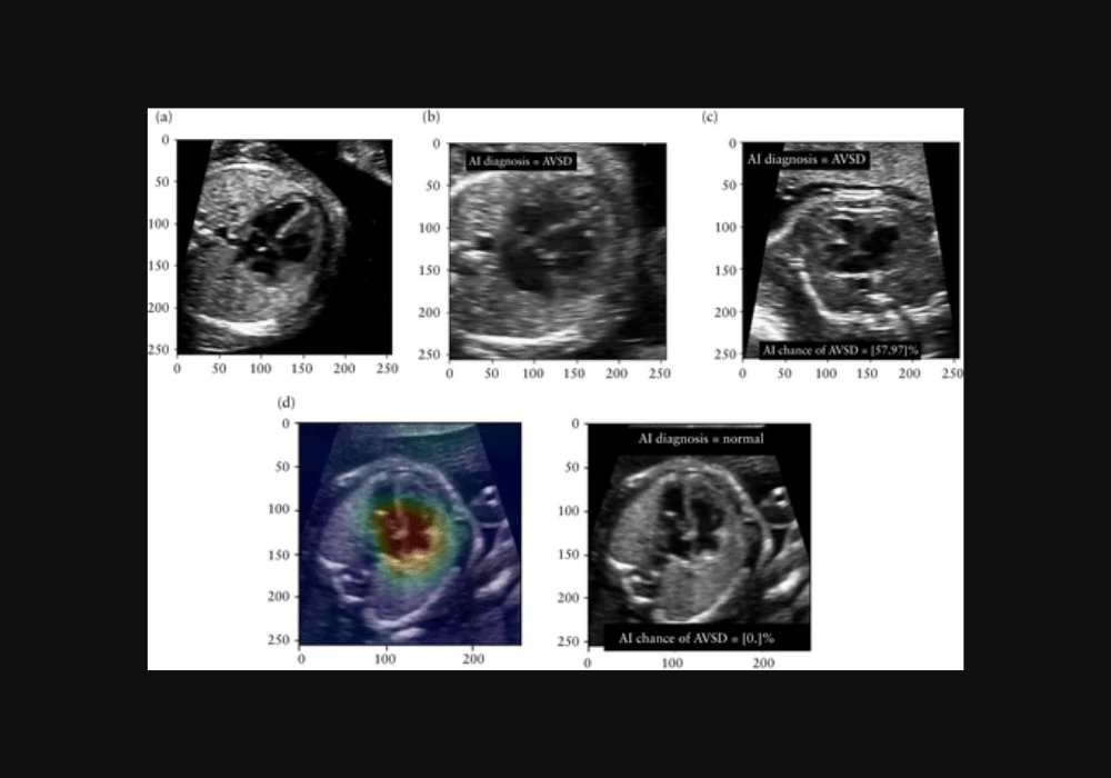 Collaborative Role of AI and US Clinicians in Detecting Congenital Heart Defects