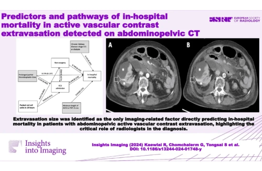 Predicting In-Hospital Mortality in AVCE Patients on Abdominopelvic CT