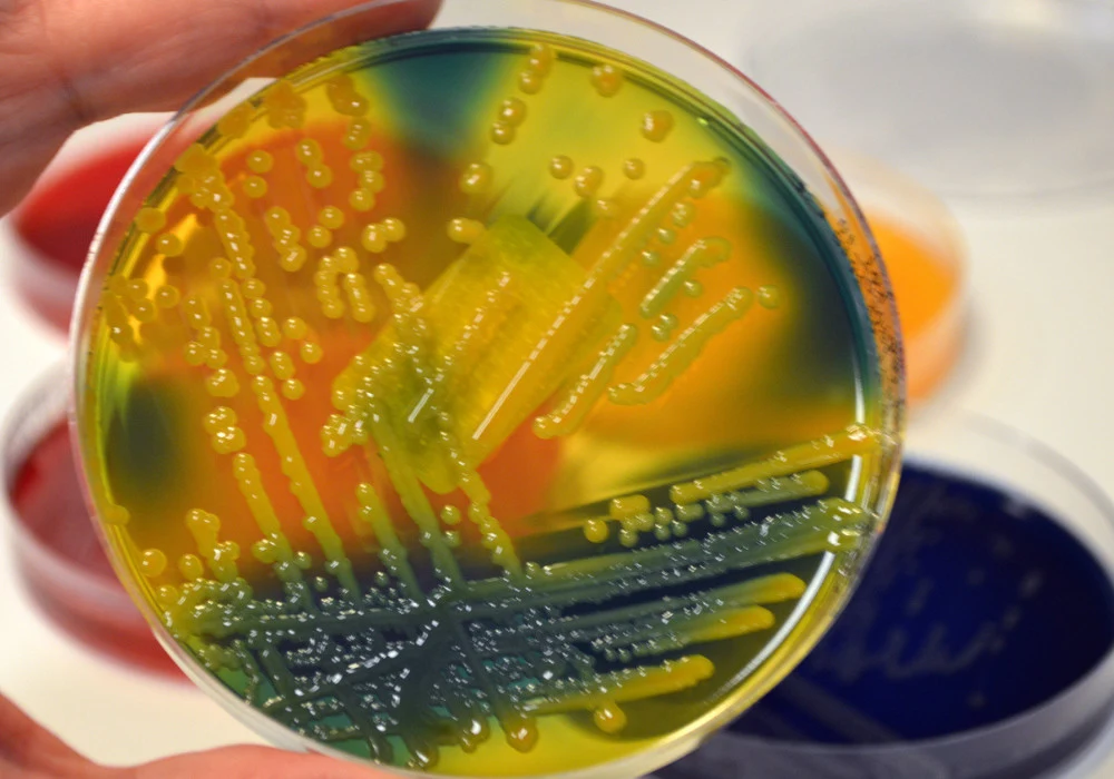 Multidrug-resistant Colonising Opportunistic Pathogens in the Oral Microbiome