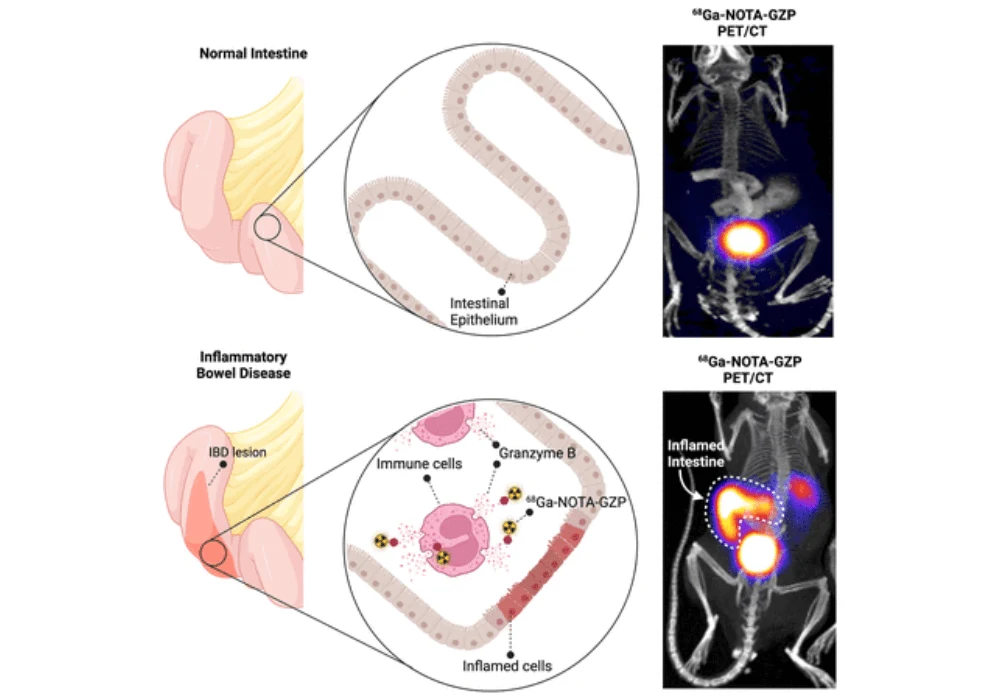 GZMB PET for Non-invasive Imaging for Inflammatory Bowel Disease